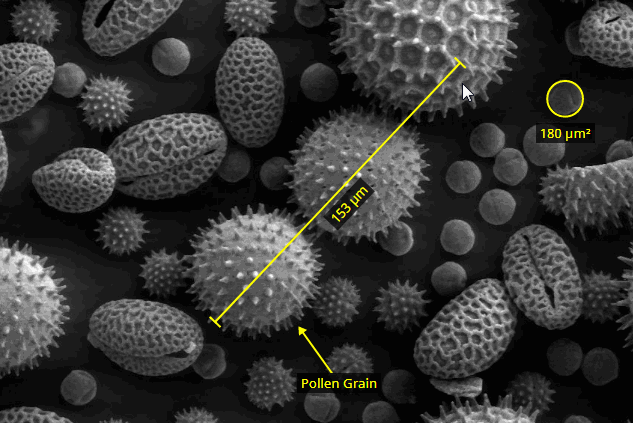A a react component for measuring & annotating images built with modern frontend techniques for responsive and reusable UI.